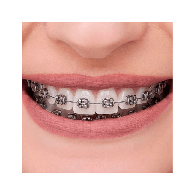 Kit Braquete de Aco Advanced Roth 022 100 Casos  120 Tubos  Orthometric