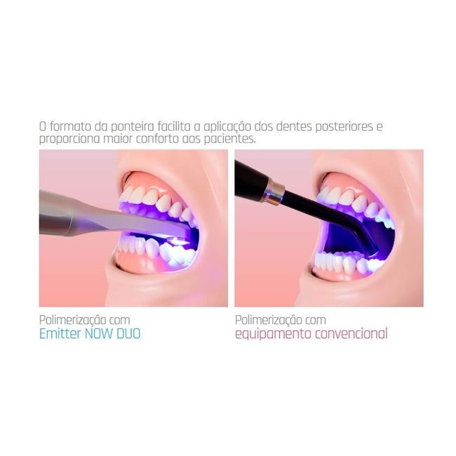 Fotopolimerizador Emitter Now Duo  Schuster