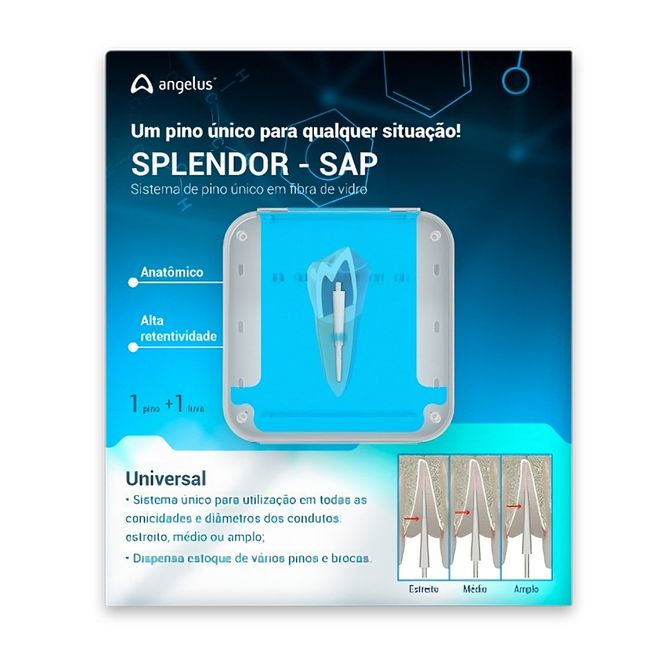 1000033735-1-Pino-de-Fibra-de-Vidro-Splendor-SAP-1-Pino-1-Luva-Angelus