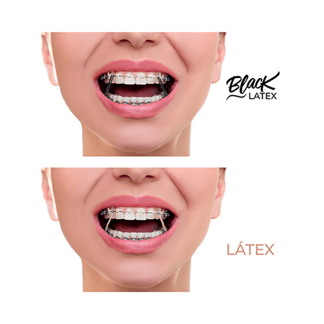 Elastico Intraoral Antimicrobiano Black Medio 516  Morelli